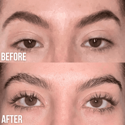 Wimpernwachstumsserum Für Längere, Dichtere Wimpern - Fortschrittliche Formel, Dermatologisch Getestet