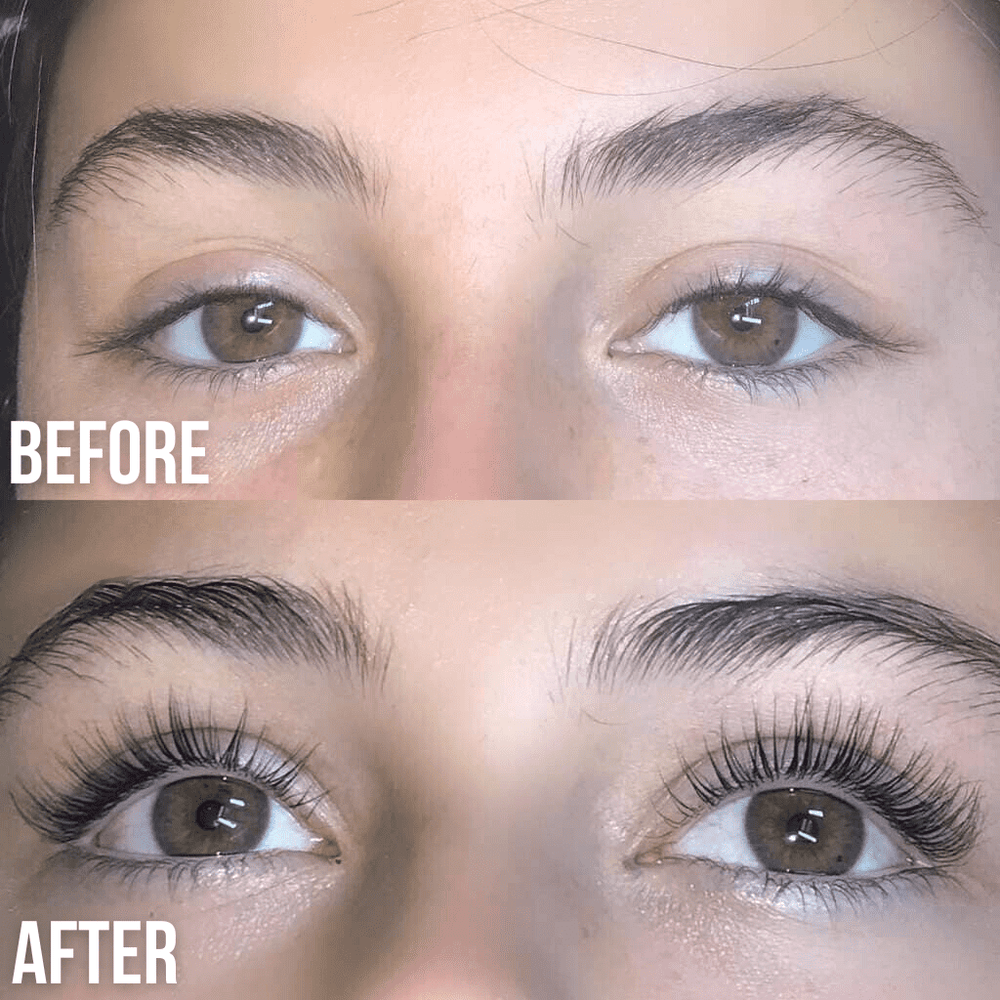 Wimpernwachstumsserum Für Längere, Dichtere Wimpern - Fortschrittliche Formel, Dermatologisch Getestet